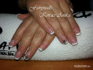 az örök divat francia zselés köröm