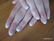 Ballagós zselé építés