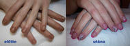 Best Nails - előtte és utána