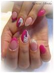 Pinky