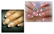before after