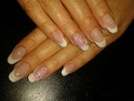 Röntgen rózsás Épített zselé