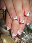 glitteres zselés