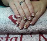 francia rágott körömre