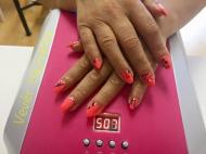 Zselés megerősítés