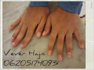 Zselés megerősítés kövekkel