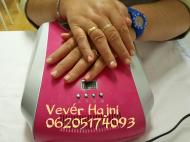 Zselés megerősítés egyszerűen