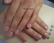 zselés erősítés1