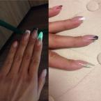 MyGlow