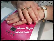 Hópihés zselés megerősítés