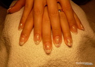 glitteres