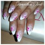 Anett