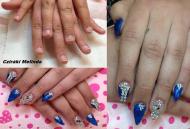 Épített extrém köröm