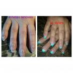 Best Nails - Zselés töltés 