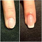 Elötte utána épitett francia