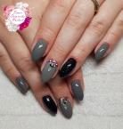 Szürke köröm kövekkel