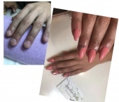 Reconstrucción uñas mordidas