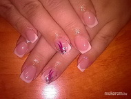 Körömágyhosszabbítással