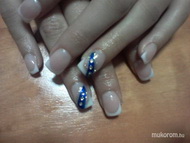 Körömágyhosszabbítással