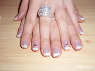 Sajátköröm megerősítése 