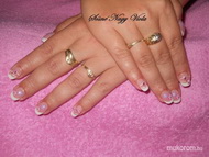 Francia beépített gumidíszekkel