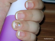 lenövésmentes körömerősítés