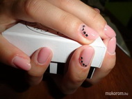 Körömágyhosszabító