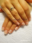 Gel lac