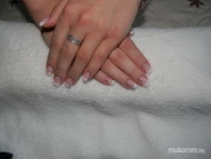 Francia köröm  kövekkel