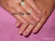 Körömágyrövidítéssel