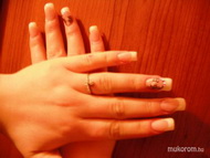 Köves akril díszités