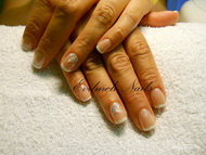 Gel lac