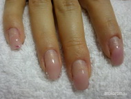 a vendégem 8 hetes körme