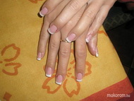 Tippes francia zselé