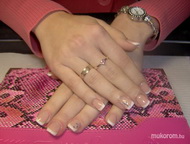 Francia káh kövecskékkel