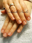 Gel lac