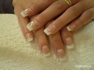 épített zselés francia