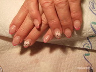 Anyukám 5 hetes lenőtt körme