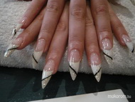 lenőtt három hetes köröm