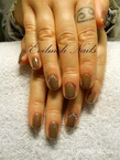 Gel lac