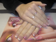 Aminak kövecskékkel