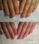 egészségügyi beavatkozás