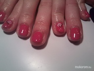 Katinak gel lac akrillal