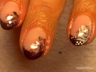 röntgen rózsás körmök