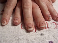 Sógornőmnek gél lac