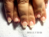 Nagyon nagyon kicsi  rágott köröm