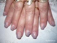 zselés és akril diszités