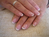 csak kövek legyenek....