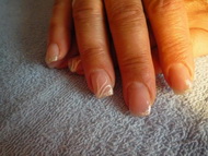 anyának porci alappal