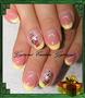 Yellow nail